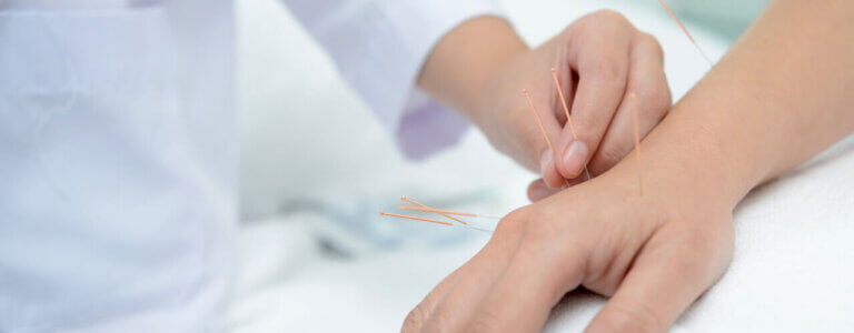 Acupuncture Could Help You Live Comfortably Again